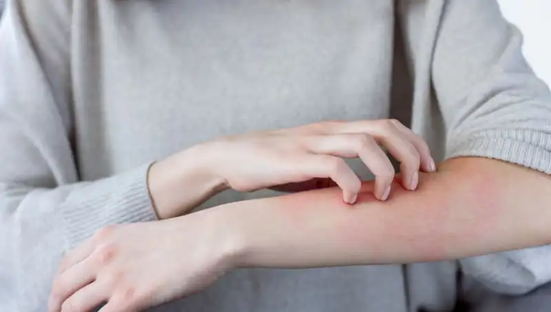 Cilt Kanseri Belirtilerini Gözden Kaçırmayın: Dermatolog Uyarıyor